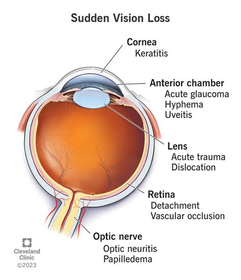 Unraveling the Origins: What Triggers Dreams of Eyeball Loss?