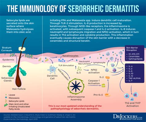 Unraveling the Role of Sebum in Dandruff Formation