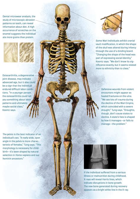 Unveiling Insights through Human Skeletal Analysis