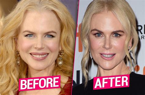 Unveiling Nini Kidman's Physical Characteristics