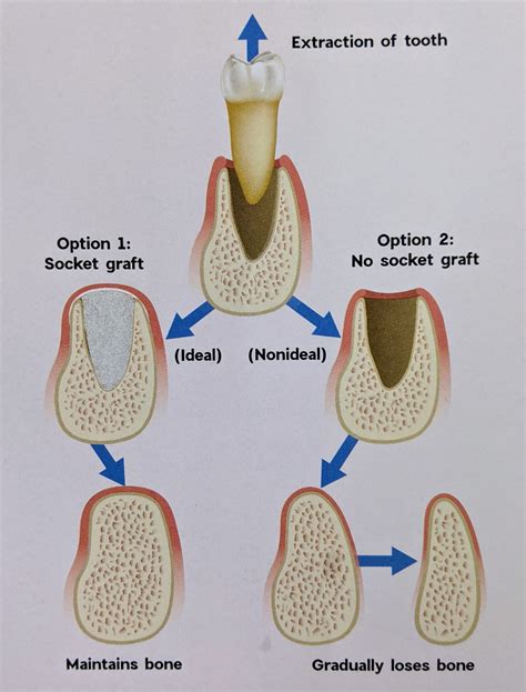 Visions of Dental Loss: Factors, Explanations, and Solutions