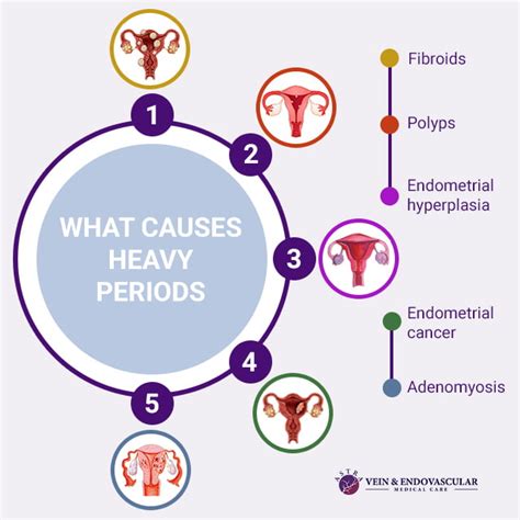 What Causes Heavy Menstrual Flow?