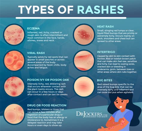 When to Seek Medical Advice: Identifying Concerning Symptoms of a Facial Skin Rash