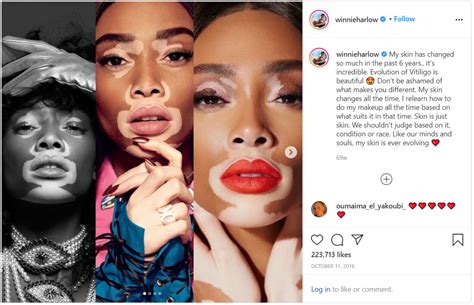 Winnie Harlow's Body Positivity and Advocacy